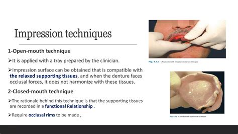 Complete Denture Impression Definition