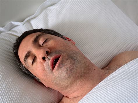 complex sleep apnea syndrome