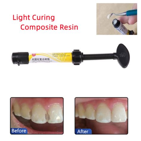 Composite Resin And Light Curing Modes