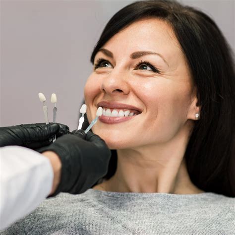 Composite Veneer Code