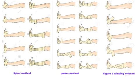 Compression Bandaging Nice Guidelines