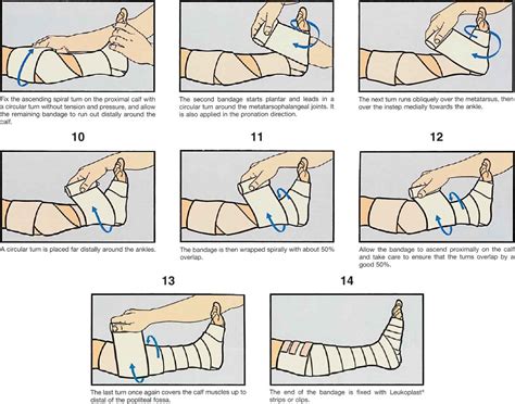 Compression Bandaging Technique