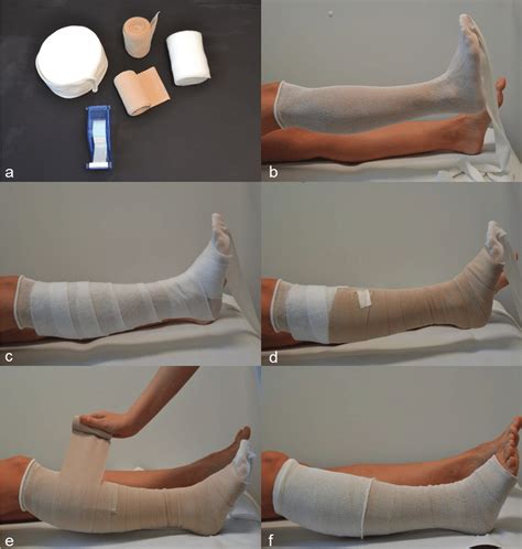 Compression Dressing Procedure