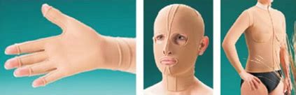 Compression Garment Burn