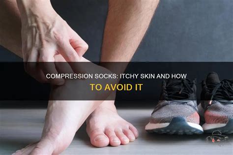 Compression Garment Itchy