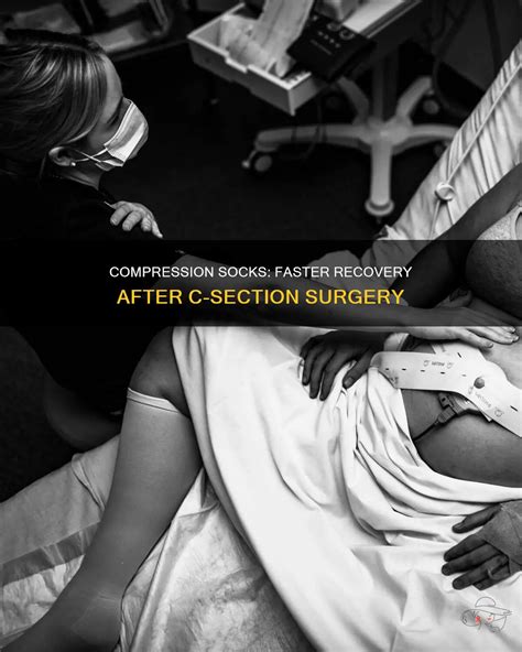Compression Socks After C Section