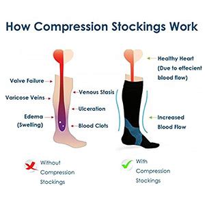 Compression Socks Vs Compression Leggings