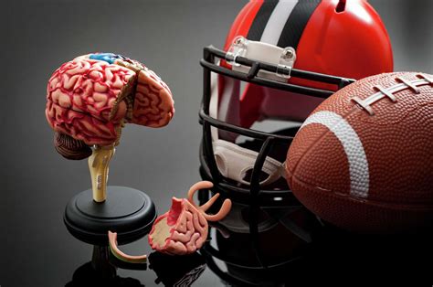 concussion syndrome in football players