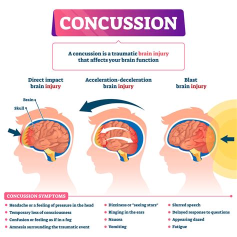 concussion traumatic brain injury