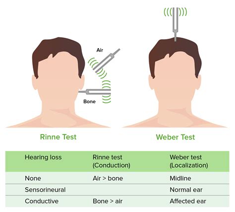 conductive hearing loss test
