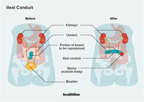 Conduit Medical Terminology