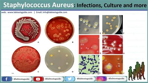 Confirmation Test For Staphylococcus Aureus