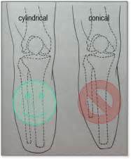 Conical Vs Cylindrical Stump