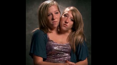 conjoined twins abby and brittany 2020