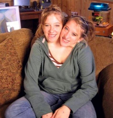 conjoined twins abby and brittany still alive