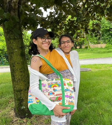 conjoined twins married