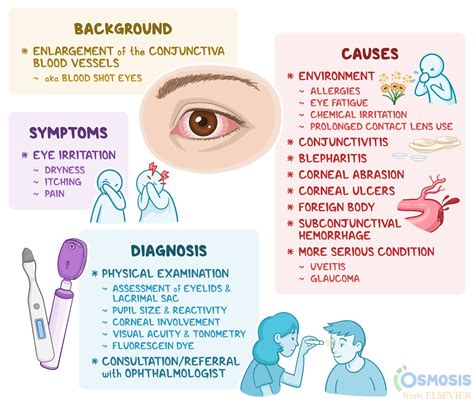 conjunctivitis treatment