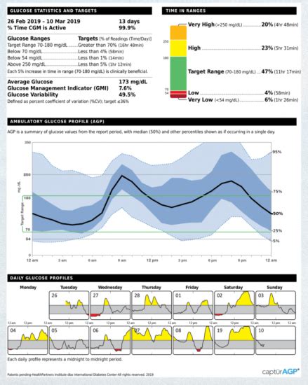 Continuous Glucose Monitoring Data Analysis