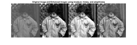 contrast enhancement techniques in image processing