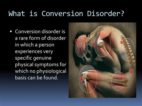 Conversion disorder power point