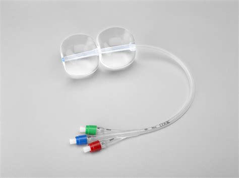 Cooks Balloon Procedure