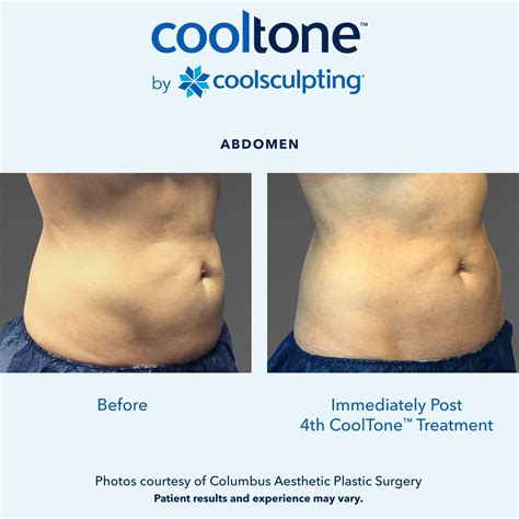 cooltone before and after reviews