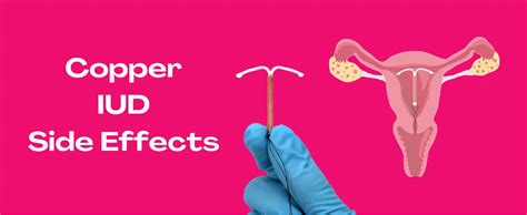 Copper Coil Side Effects Risks