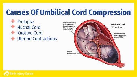 Cord Loop Causes