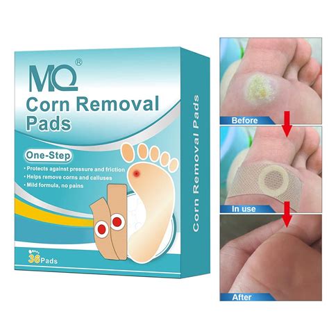 Corn Remover Pads Hurt