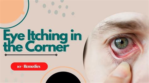 Corner Of Eye Won't Stop Itching