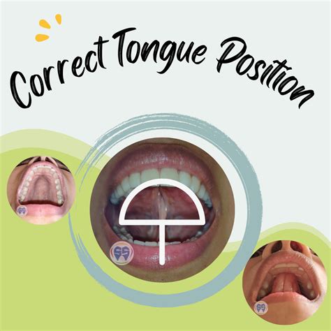 correct tongue placement in mouth