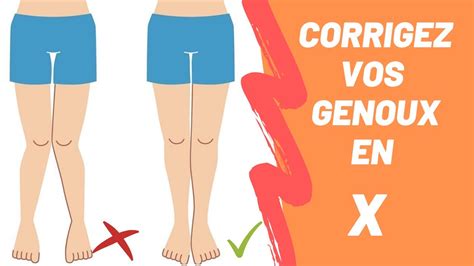 Correction Jambes En X