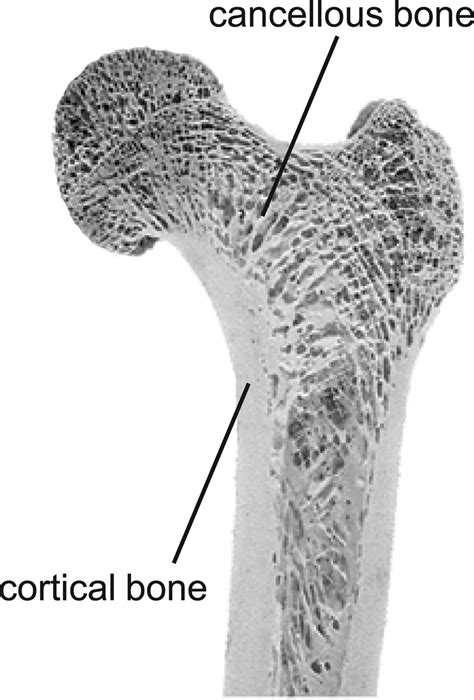 cortical and cancellous bone