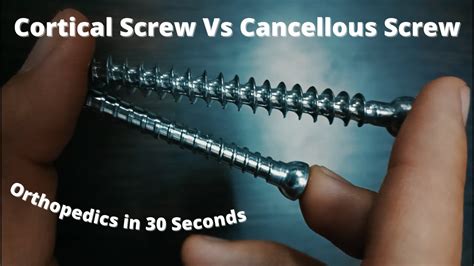 cortical vs cancellous screws