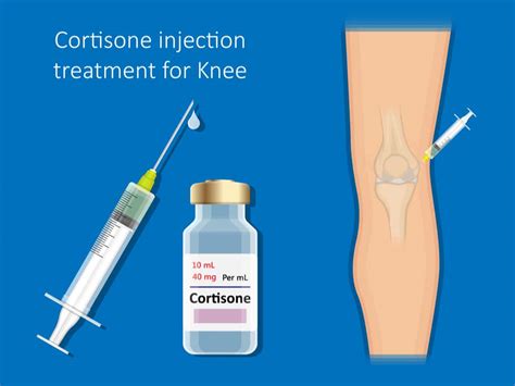 Cortisone Injection Code