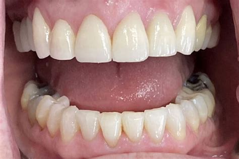 Cosmetic & Reconstructive Dentistry