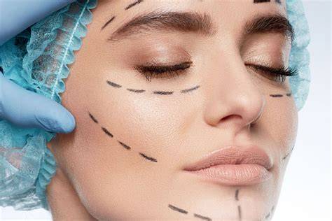 The Digital Mirror: Understanding the Rise and Impact of Cosmetic Surgery Filters