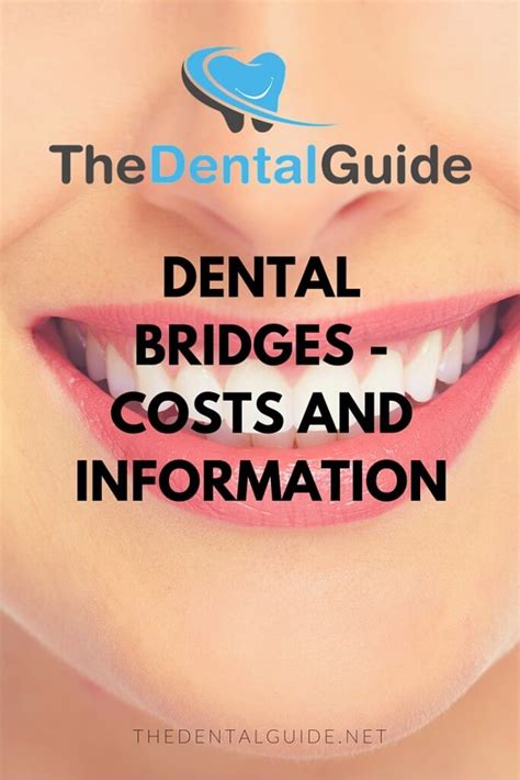 cost of dental bridges uk