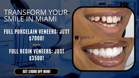 Cost Of High Quality Veneers