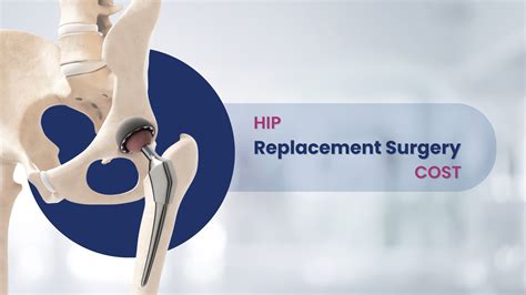 cost of hip replacement
