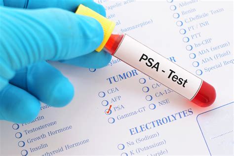 cost of psa test without insurance