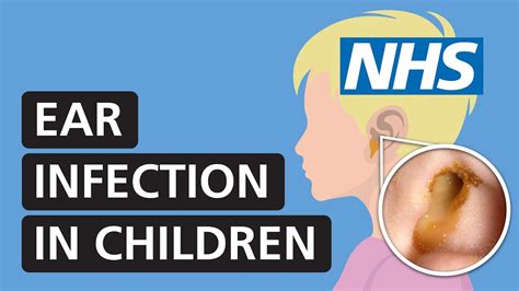Cough Ear Infection Child