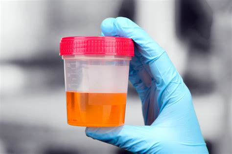 Quelle est la couleur de l'urine d'une femme en début de grossesse