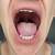covid symptom weird taste in mouth