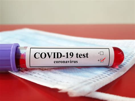 covid 19 test false negative