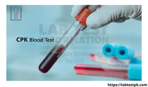 cpk mm blood test