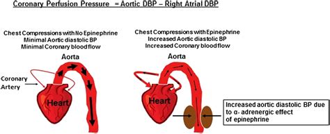 cpp equals aortic