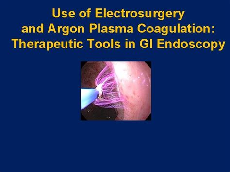 cpt code egd with argon plasma coagulation