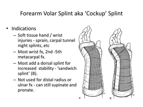 Cpt Code For Splint Application Left Wrist