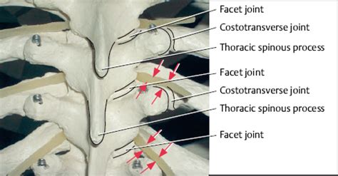 cpt code for thoracic facet joint injection